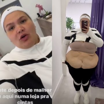 Thais Carla desabafa excesso de pele após perder 50kg: ‘A barriga está mole’