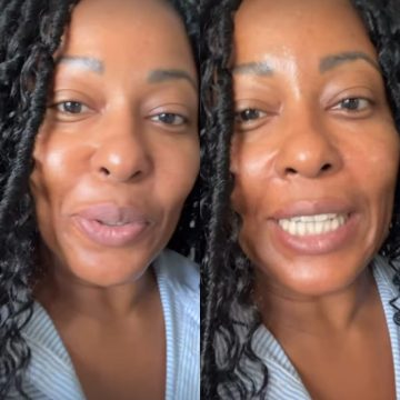 Maíra Azevedo faz cirurgia para soltar a língua e brinca: ‘Não estou me entendendo’