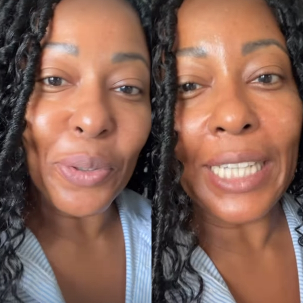 Maíra Azevedo faz cirurgia para soltar a língua e brinca: ‘Não estou me entendendo’