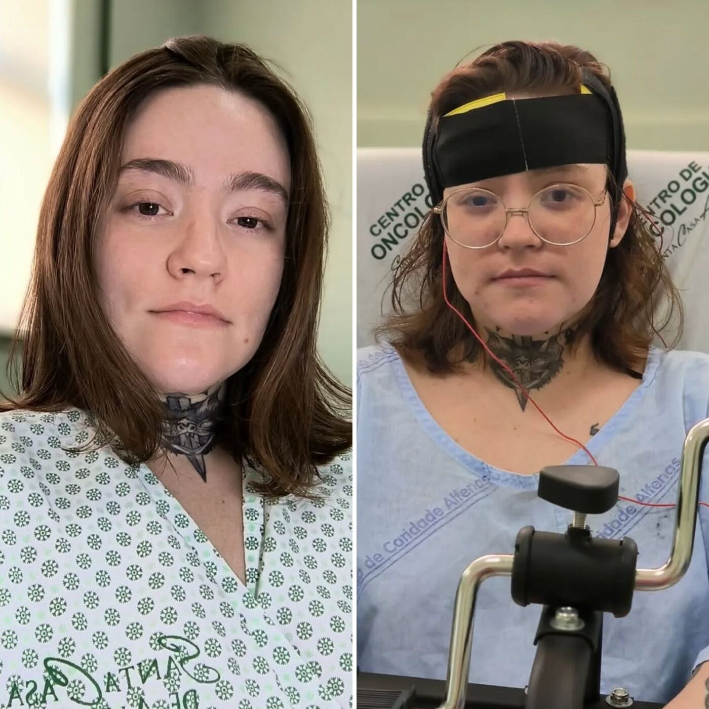 Jovem com ‘pior dor do mundo’ é submetida a sedação profunda para tentar recuperar resposta a medicamentos