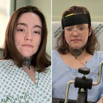 Jovem com ‘pior dor do mundo’ é submetida a sedação profunda para tentar recuperar resposta a medicamentos