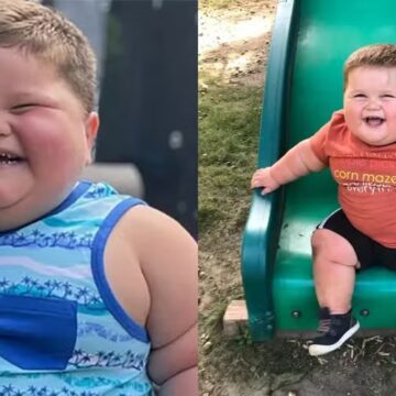 Criança de 3 anos pesava 45 quilos por causa de doença rara que o fazia chorar de fome o dia todo
