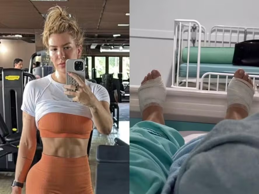 Lore Improta retoma treinos intensos após cirurgia nos pés e ‘um mês e meio sem andar’