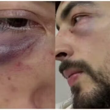 Empresário diz ter sido agredido por seguranças de karaokê em São Paulo
