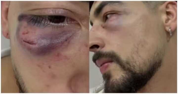 Empresário diz ter sido agredido por seguranças de karaokê em São Paulo