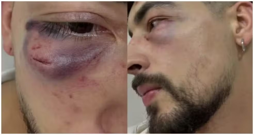 Empresário diz ter sido agredido por seguranças de karaokê em São Paulo