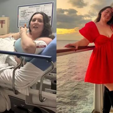 Mulher decide parar de usar calcinha após roupa íntima levá-la ao hospital: ‘Gritava de dor’