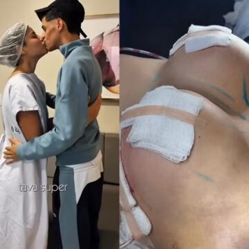 Mulher de Luva de Pedreiro, Távila Gomes coloca silicone: ‘Realização de um sonho’