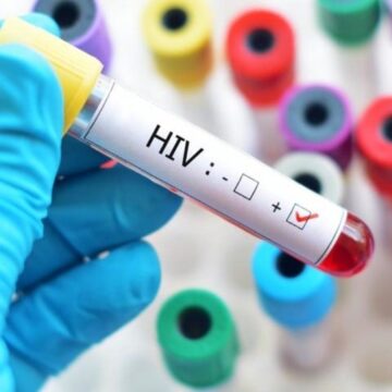 Sesab desmente boato sobre surto de HIV/Aids entre jovens na Bahia