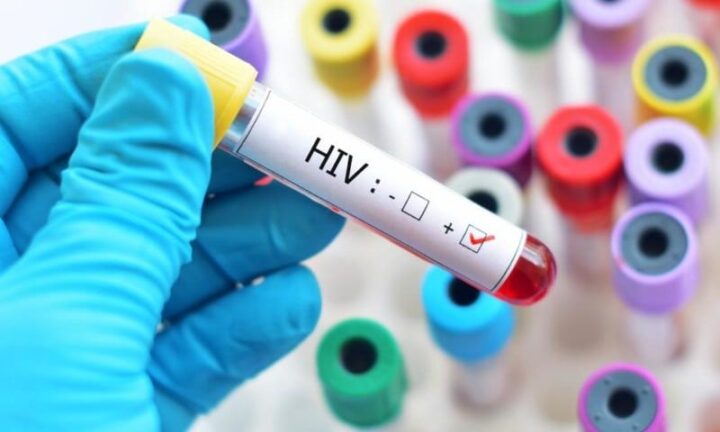 Sesab desmente boato sobre surto de HIV/Aids entre jovens na Bahia