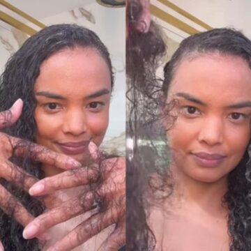 Pós-parto pode causar calvície? Especialista explica caso de Lucy Ramos