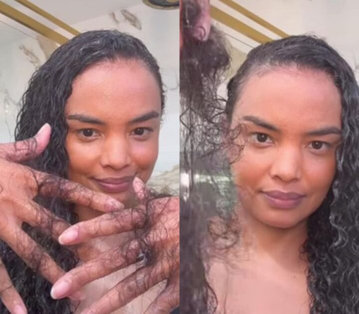 Pós-parto pode causar calvície? Especialista explica caso de Lucy Ramos