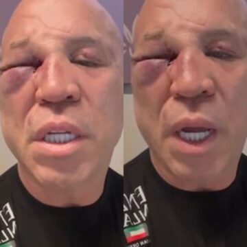 Wanderlei Silva revela perda de memória após luta com Popó
