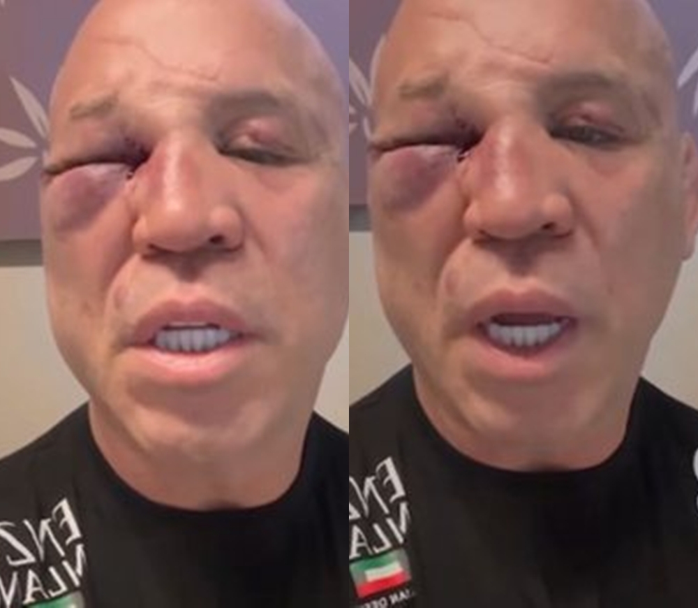 Wanderlei Silva revela perda de memória após luta com Popó