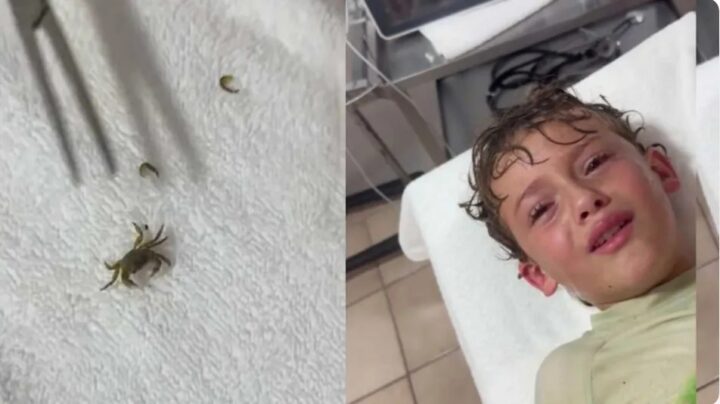 Menino tem caranguejo vivo retirado de ouvido após passeio na praia; veja vídeo