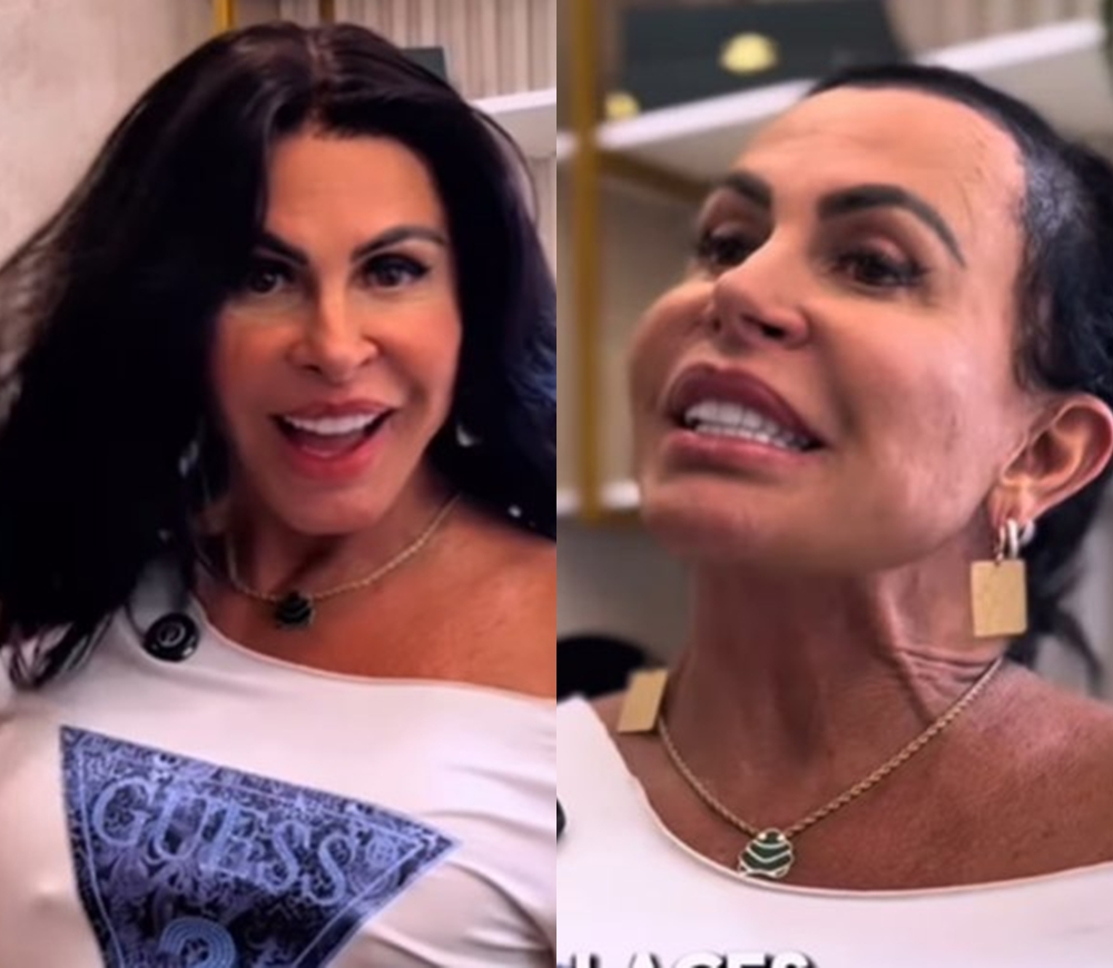 Gretchen mostra processo de transformação após diagnostico de alopecia Gretchen mostra processo de transformação após diagnostico de alopecia