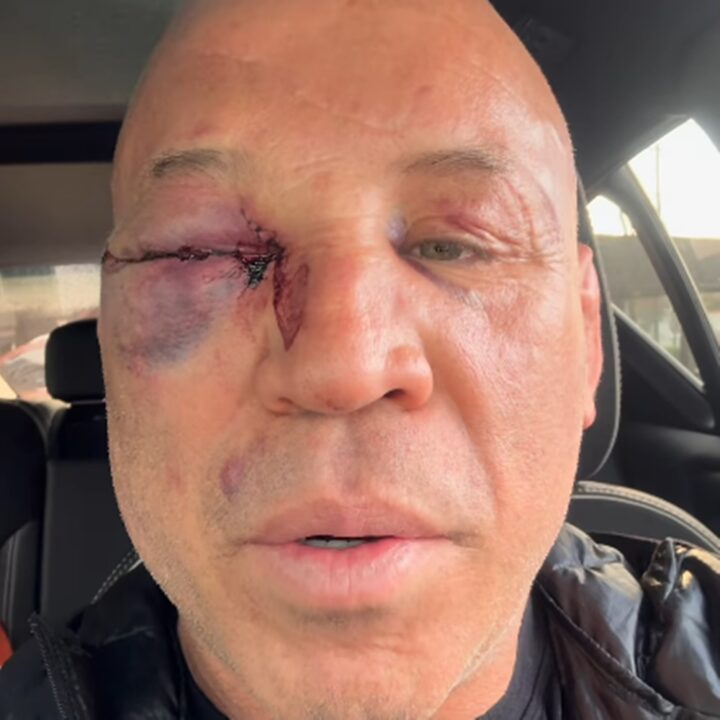 Wanderlei Silva relata fortes dores após confusão em luta contra Popó: ‘Não passa’