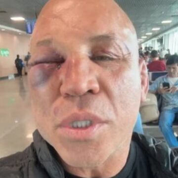 Wanderlei Silva se pronuncia após confusão com equipe de Popó: ‘Quem está na guerra está sujeito a tudo’