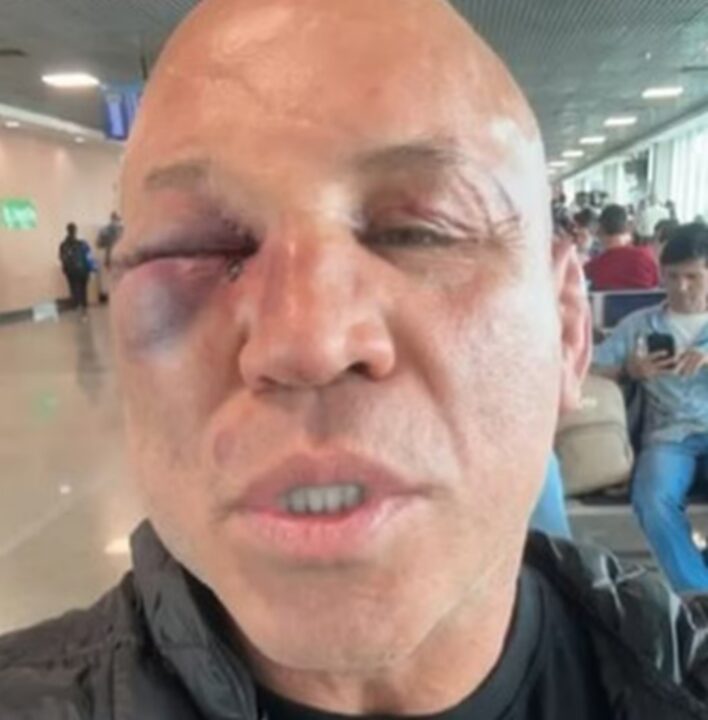 Wanderlei Silva se pronuncia após confusão com equipe de Popó: ‘Quem está na guerra está sujeito a tudo’