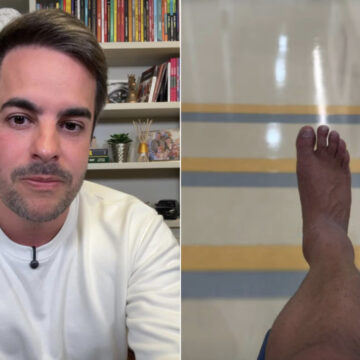 Marido de Simone Mendes atualiza estado de saúde após grave lesão no tornozelo: “Um mês e meio sem pisar no chão”