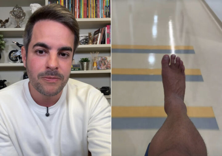 Marido de Simone Mendes atualiza estado de saúde após grave lesão no tornozelo: “Um mês e meio sem pisar no chão”