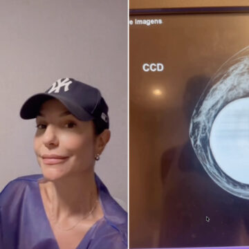 Ivete Sangalo passa por exame e faz alerta: “Cuidado nunca é demais”