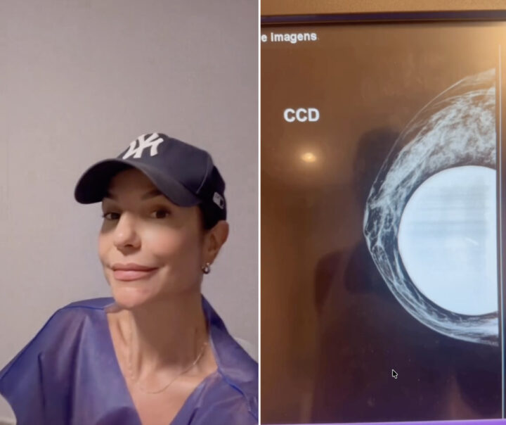 Ivete Sangalo passa por exame e faz alerta: “Cuidado nunca é demais”