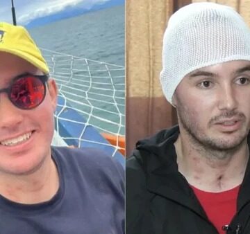 Motoboy que ficou cego após beber uísque com metanol tem alta após 45 dias