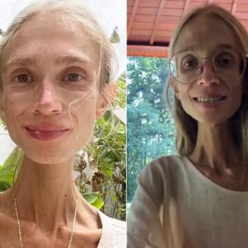 Dançarina é achada morta em hotel de Bali após adotar dieta frutariana extrema e pesar apenas 22 quilos