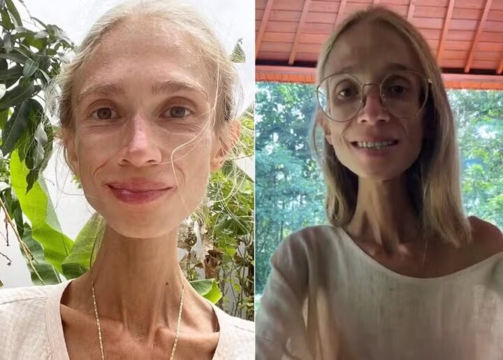 Dançarina é achada morta em hotel de Bali após adotar dieta frutariana extrema e pesar apenas 22 quilos