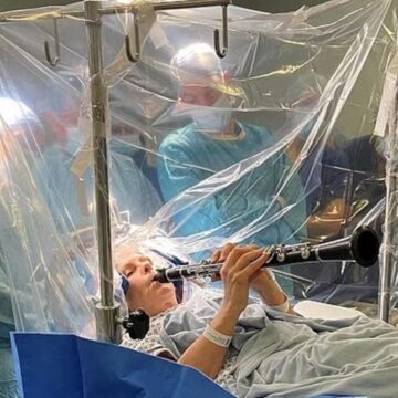 VÍDEO: Mulher com Parkinson volta a tocar clarinete durante cirurgia no cérebro