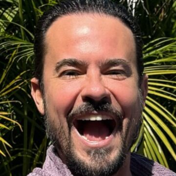 Paulinho Vilhena faz plástica nos olhos e exibe resultado para fãs; veja foto Paulinho Vilhena faz plástica nos olhos e exibe resultado para fãs; veja foto