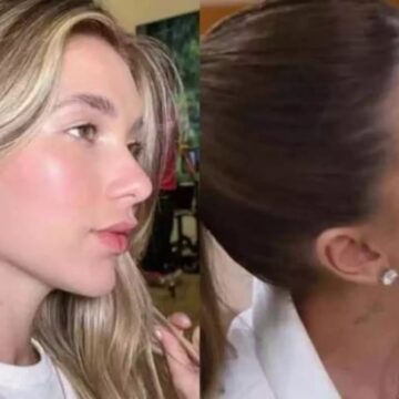 Virginia Fonseca apaga tatuagem de Zé Felipe e mostra procedimento