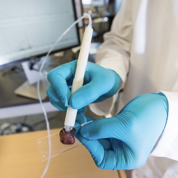 Pesquisadora brasileira desenvolve caneta que identifica câncer em segundos