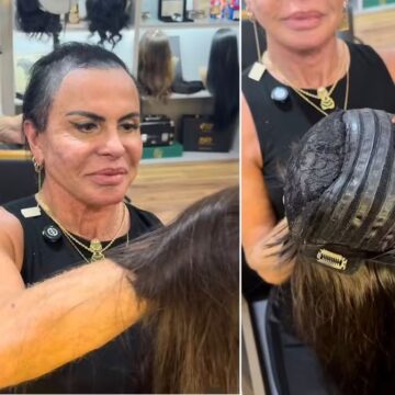 Gretchen ganha prótese capilar especial durante tratamento de alopecia
