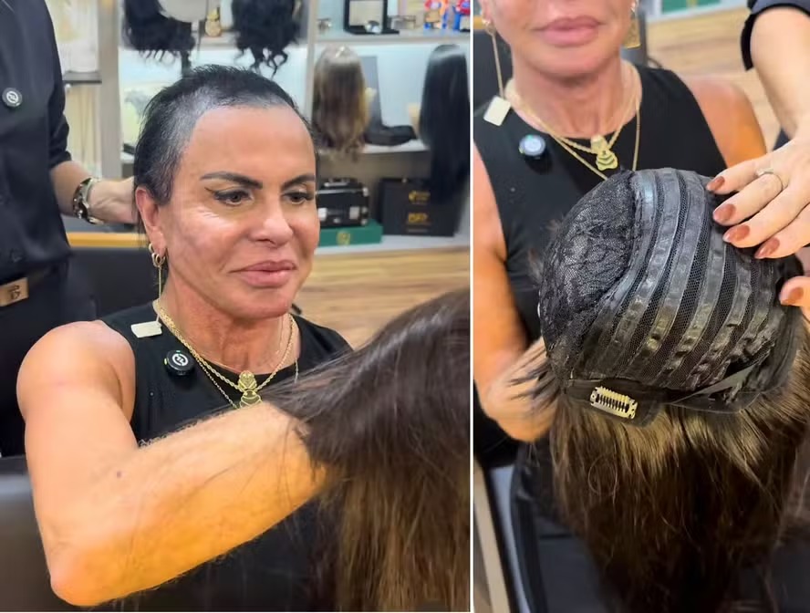 Gretchen ganha prótese capilar especial durante tratamento de alopecia