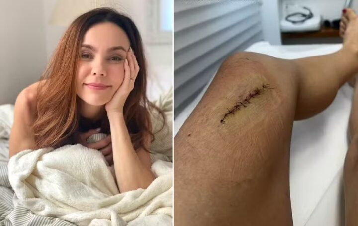 Flávia Monteiro fala sobre diagnóstico de câncer de pele: ‘Uma micro pinta era um melanoma’