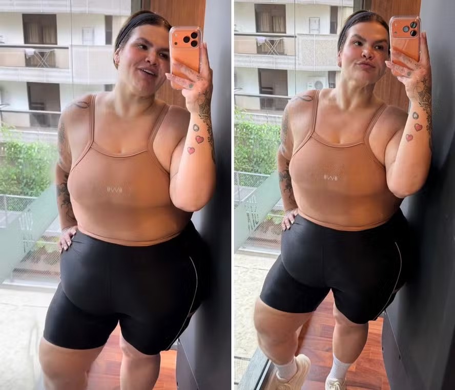 Com menos 72kg após bariátrica, Thais Carla celebra ‘trapézio’