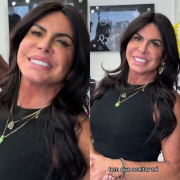 Sem filtro! Aos 66 anos, Gretchen faz harmonização no glúteo e mostra resultado