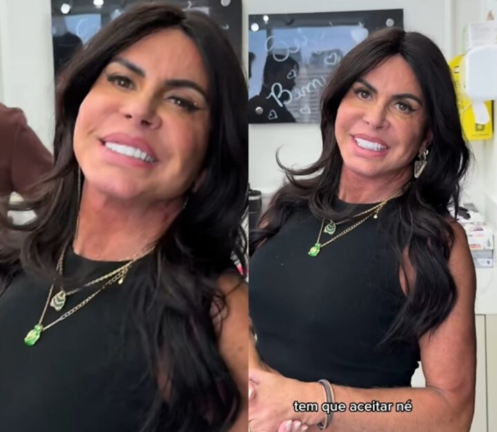 Sem filtro! Aos 66 anos, Gretchen faz harmonização no glúteo e mostra resultado