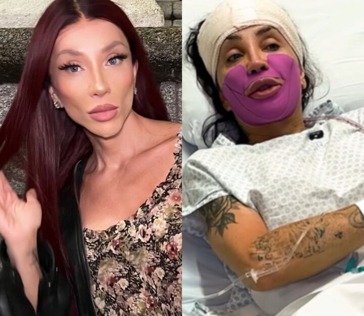 Maya Massafera faz cirurgia para tirar parte do maxilar e explica motivo: ‘Vai ajudar’