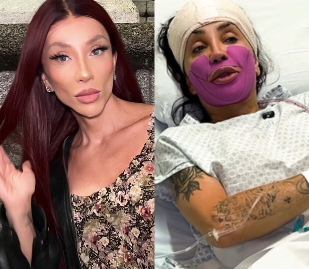 Maya Massafera faz cirurgia para tirar parte do maxilar e explica motivo: ‘Vai ajudar’