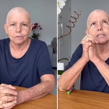 Roseana Sarney fala sobre tratamento contra câncer: “Passei uma semana difícil”