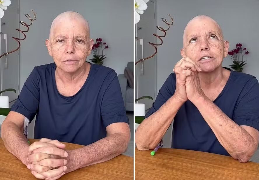 Roseana Sarney fala sobre tratamento contra câncer: “Passei uma semana difícil”