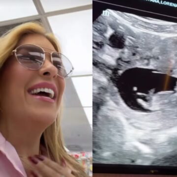 Lore Improta mostra ultrassom da segunda gravidez e se emociona: ‘Tá dançando’