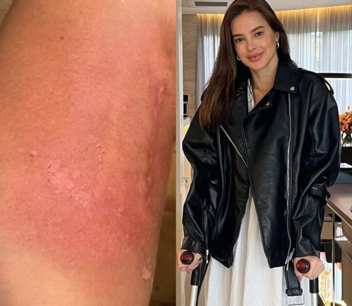 Vera Viel emociona ao falar sobre tratamento de câncer e mostra imagens: ‘Não foi fácil’