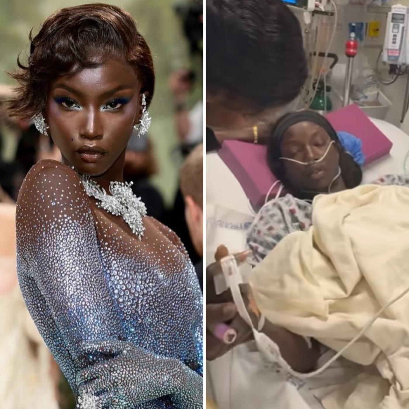 Eleita ‘Modelo do Ano’, Anok Yai revela cirurgia no pulmão após descobrir anomalia cardíaca