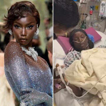 Eleita ‘Modelo do Ano’, Anok Yai revela cirurgia no pulmão após descobrir anomalia cardíaca