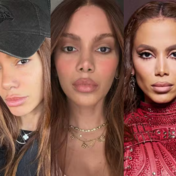 Anitta reage a pergunta sobre ‘novo rosto’ após cirurgias plásticas