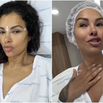 Ex-BBB Ariadna Arantes faz cirurgia para mudar a voz: ‘Mais harmoniosa’